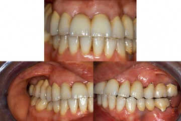 Fig.11 visione frontale e laterale nel paziente