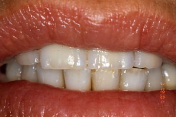 Fig.1 estetica finale