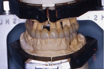 Fig.7   provvisori 