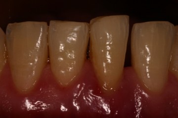 Particolare del dente