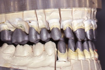Figura 8 PARTICOLARE DELLE FUSIONI PROGETTATE PER MASSA A SPALLA