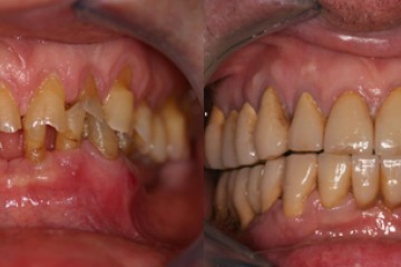 fig.10 Pre e Post Trattamento
