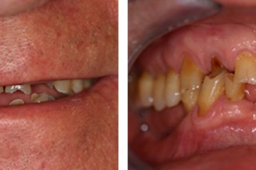 fig.1 Paziente in prima visita