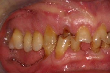 fig.2 visione laterale dx