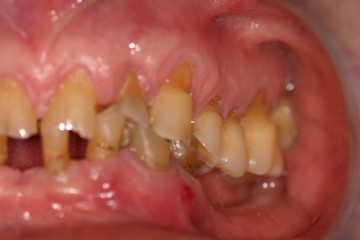 fig 3 visione laterale sn