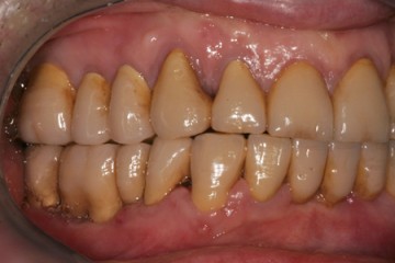 fig.7 Visione laterale dx