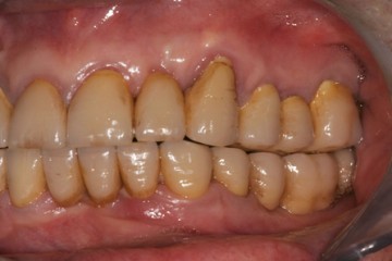 fig. 8  visione laterale sn