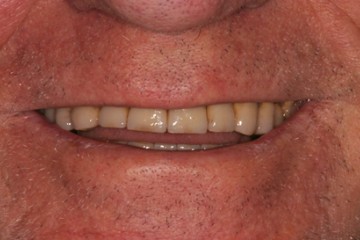 fig.9 sorriso